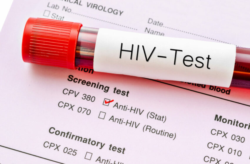  Moderna B’Vaċċin Ġdid Kontra L-HIV